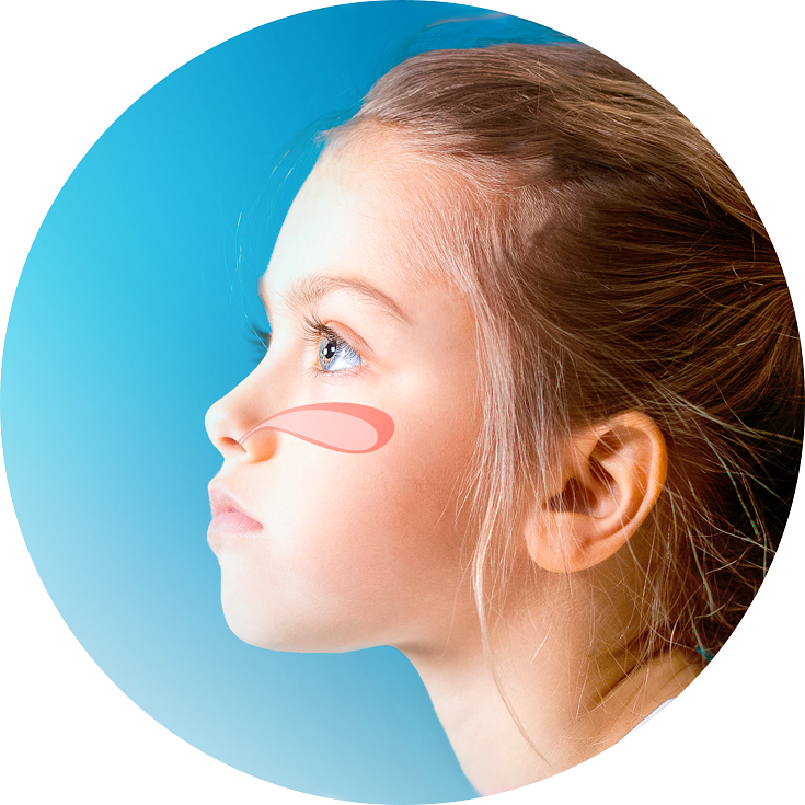 Заложенность носа у ребенка 5 лет. Заложенность носа без насморка. Снимок заложенности носа.
